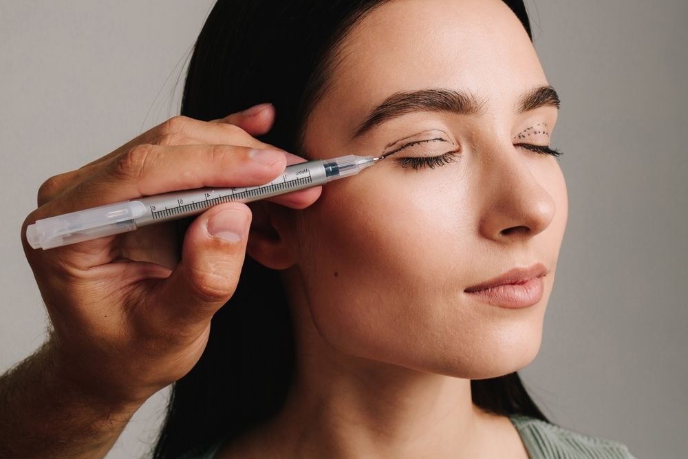 Oční plastická chirurgie